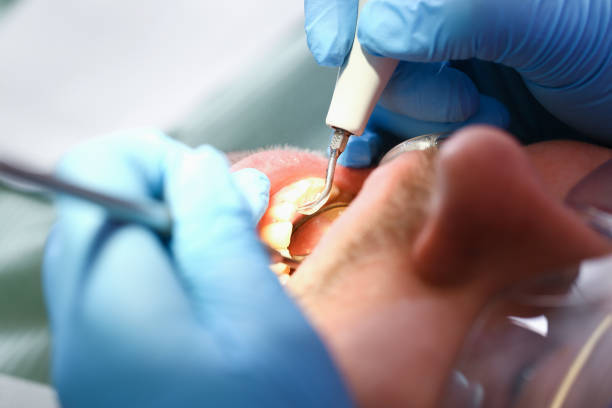 Best Cracked Tooth Emergency Dentist  in Gladewater, TX