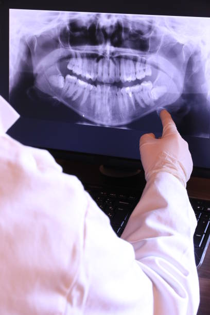 Best Chipped Tooth Repair Near Me  in Gladewater, TX
