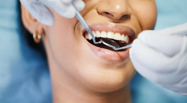 Best Emergency Tooth Extraction  in Gladewater, TX
