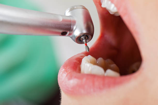 Best Dentist for Dental Trauma  in Gladewater, TX
